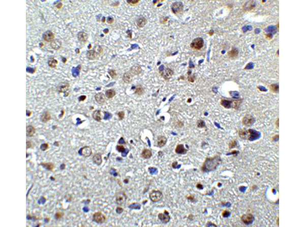 Immunohistochemistry of PLAGL2
