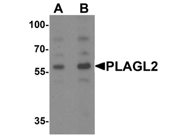 Western blot analysis of PLAGL2