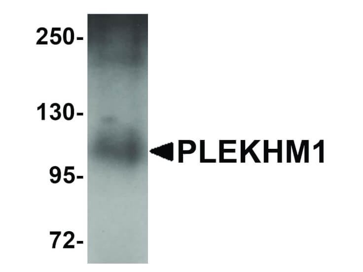 Western Blot of PLEKHM1 Antibody