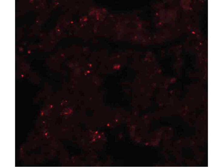 Immunofluorescence of PLEKHM1 Antibody