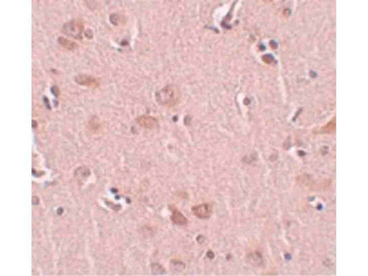 Immunohistochemistry of PLEKHM2 Antibody