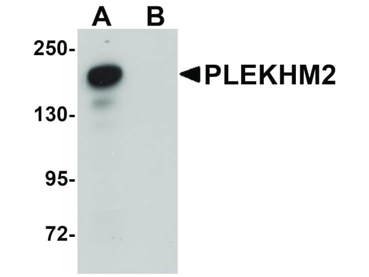 Western Blot of PLEKHM2 Antibody