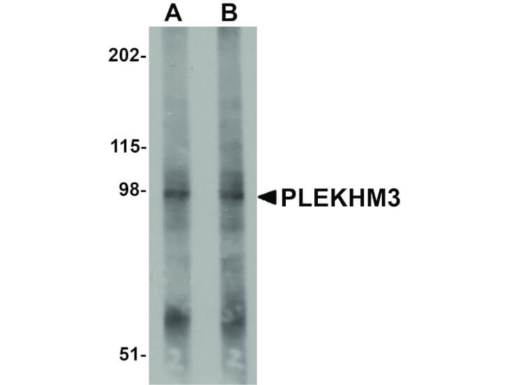 Western Blot of PLEKHM3 Antibody