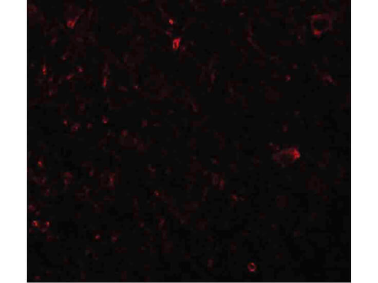 Immunofluorescence of PLEKHM3 Antibody