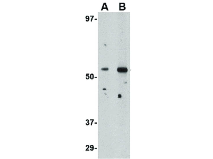 Western Blot of Plxdc2 Antibody