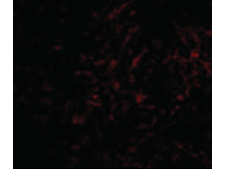 Immunofluorescence of Plxdc2 Antibody