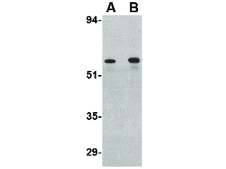 Western Blot of Plxdc2 Antibody