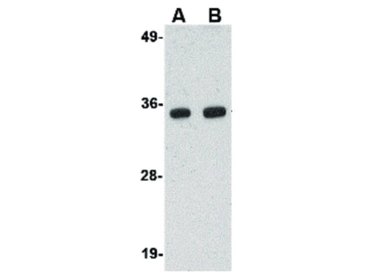 Western Blot of POLR3F Antibody