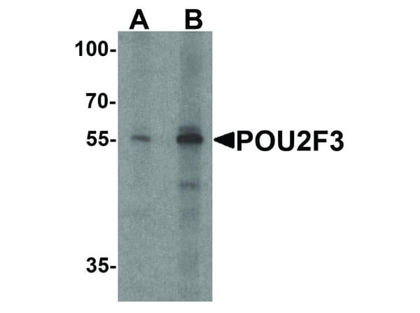 Western Blot of POU2F3 Antibody