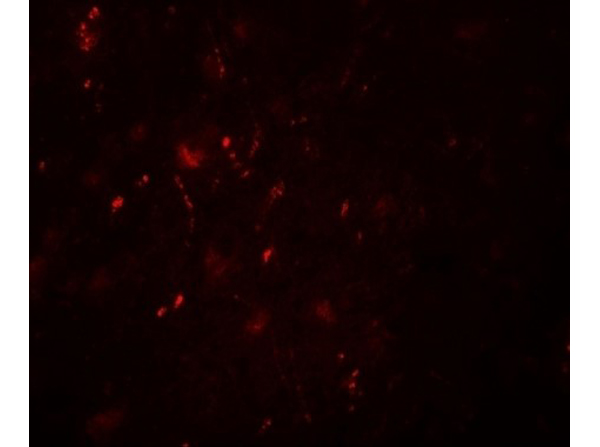 Immunofluorescence of POU3F2