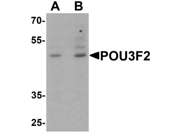 Western blot analysis of POU3F2