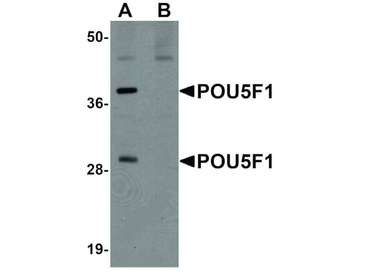 Western Blot of POU5F1 Antibody
