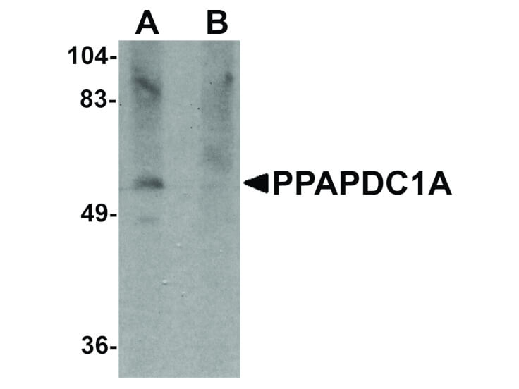 Western Blot of PPAPDC1A Antibody