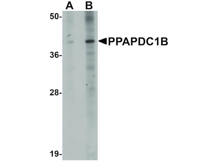 Western Blot of PPAPDC1B Antibody