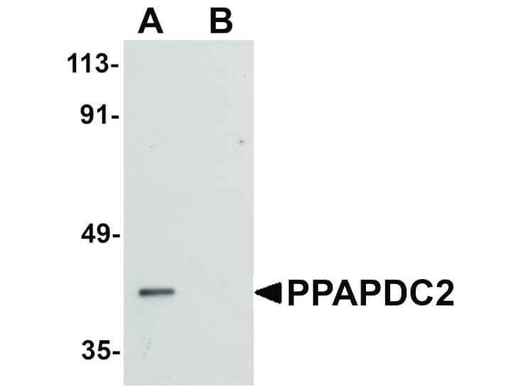 Western Blot of PPAPDC2 Antibody