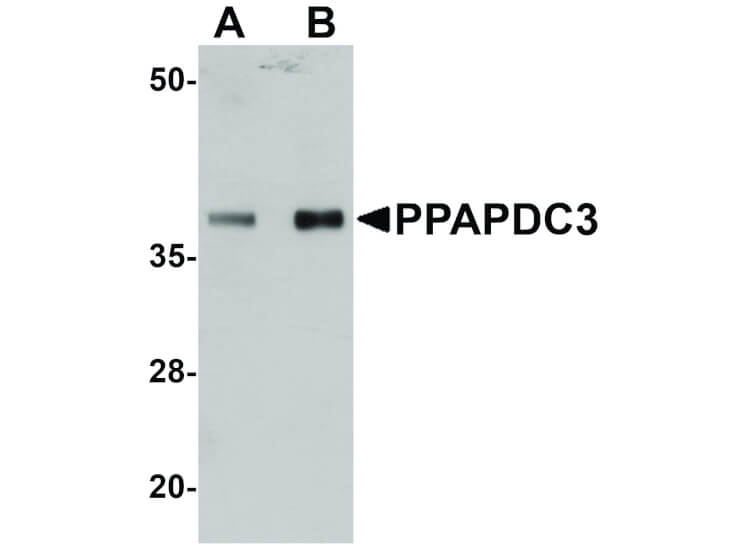 Western Blot of PPAPDC3 Antibody