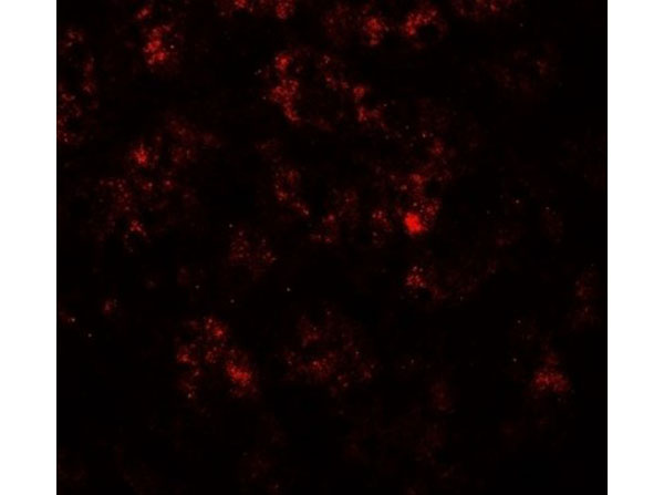 Immunofluorescence of PPARGC1A