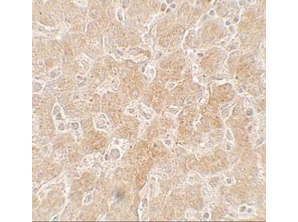 Immunohistochemistry of PPARGC1A