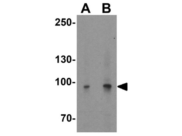 Western blot of PPARGC1A