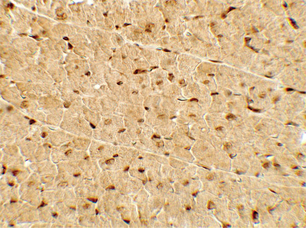 Immunohistochemistry of PPARGC1A Antibody