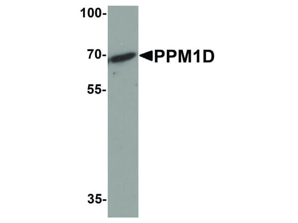 Western Blot of PPM1D Antibody