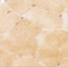 Immunohistochemistry of PRC1