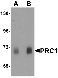 Western blot analysis of PRC1
