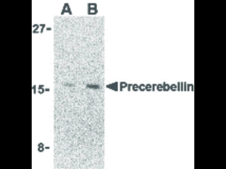 Western Blot of Precerebellin Antibody