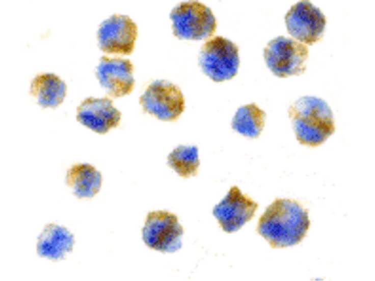 Immunocytochemistry of Precerebellin Antibody