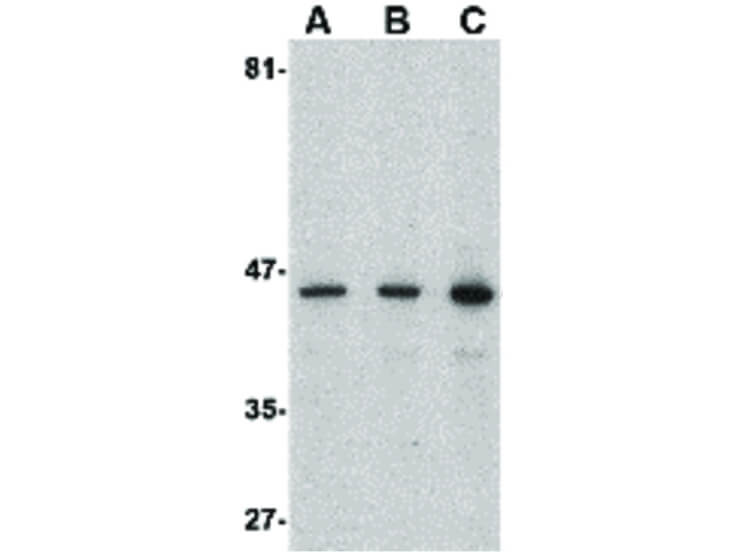 Western Blot of Presenilin1 Antibody