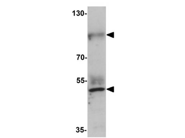 Western blot analysis of PRICKLE2