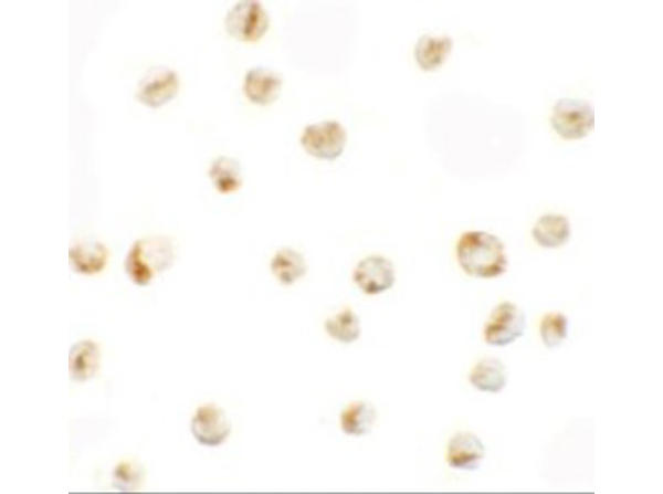Immunocytochemistry of PRICKLE4