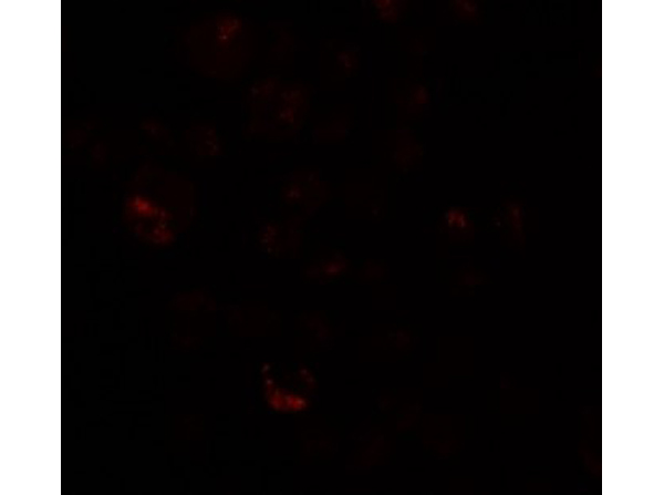 Immunofluorescence of PRICKLE4