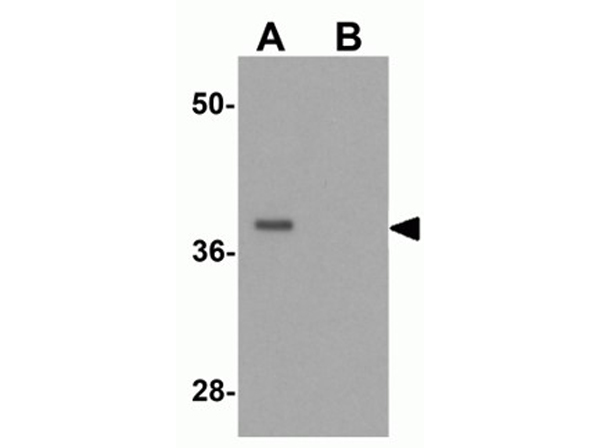Western blot analysis of PRICKLE4