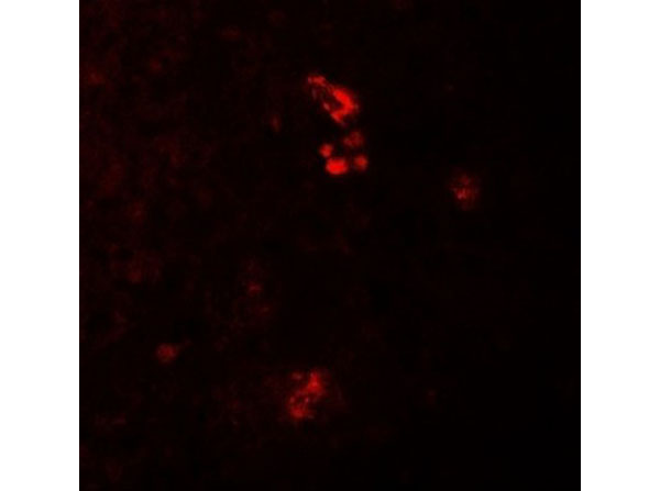Immunofluorescence of PRKCDBP