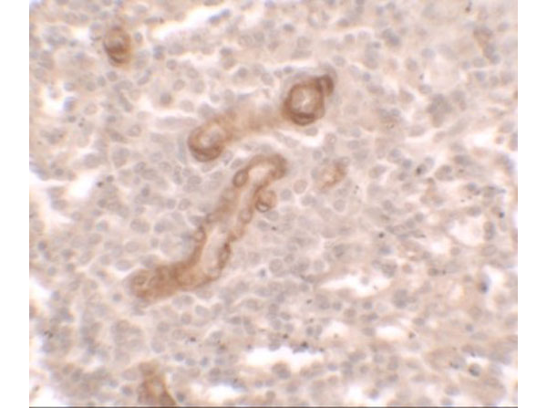 Immunohistochemistry of PRKCDBP