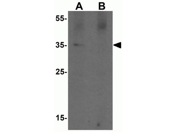 Western blot analysis of PRKCDBP