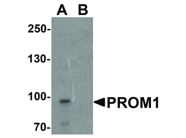 Western Blot of PROM1 Antibody
