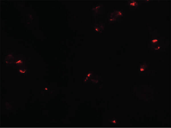 Immunofluorescence of PROM1 Antibody