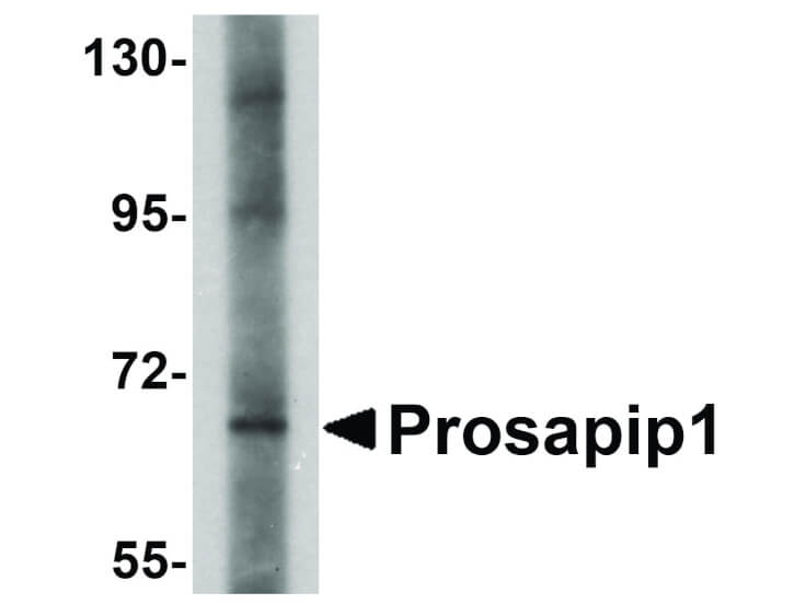 Western Blot of Prosapip1 Antibody