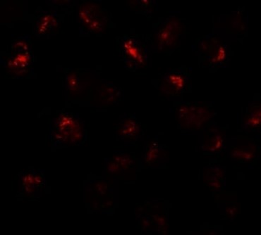 Immunofluorescence of PRR5L