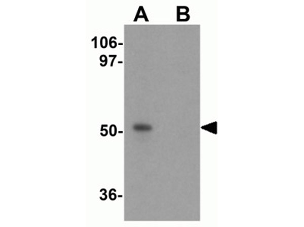 Western blot analysis of PRR5L