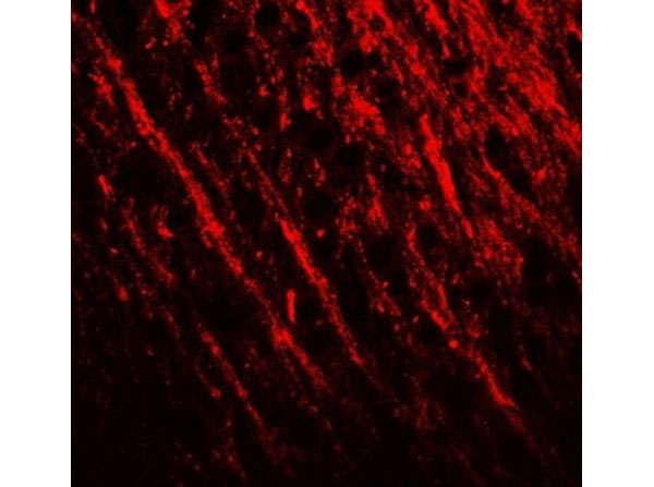 Immunofluorescence of PRRT2