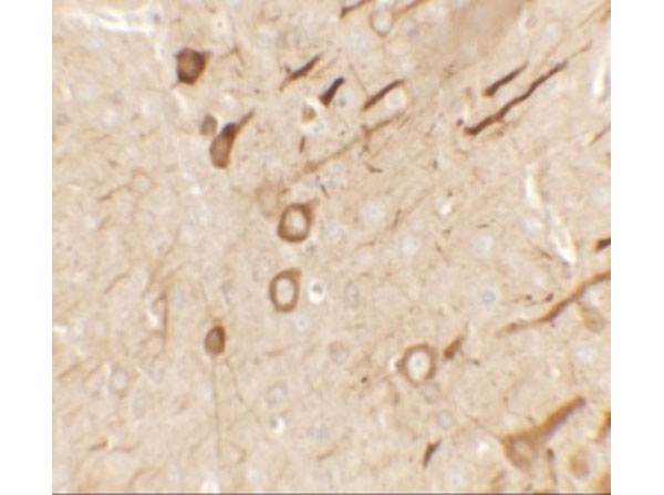 Immunohistochemistry of PRRT2