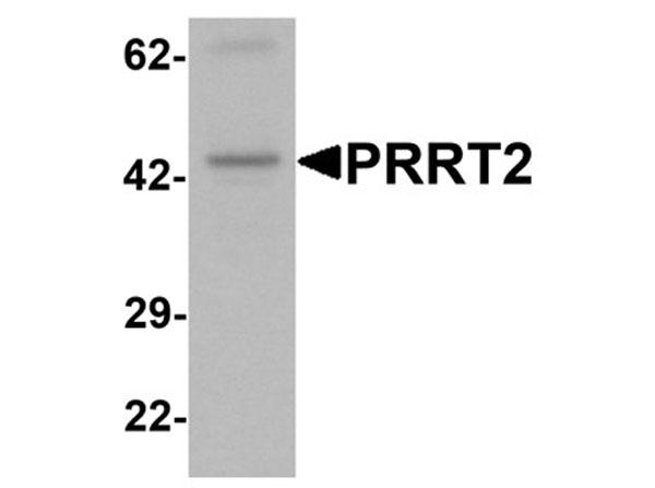 Western blot analysis of PRRT2