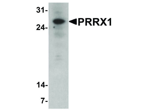 Western Blot of PRRX1 Antibody