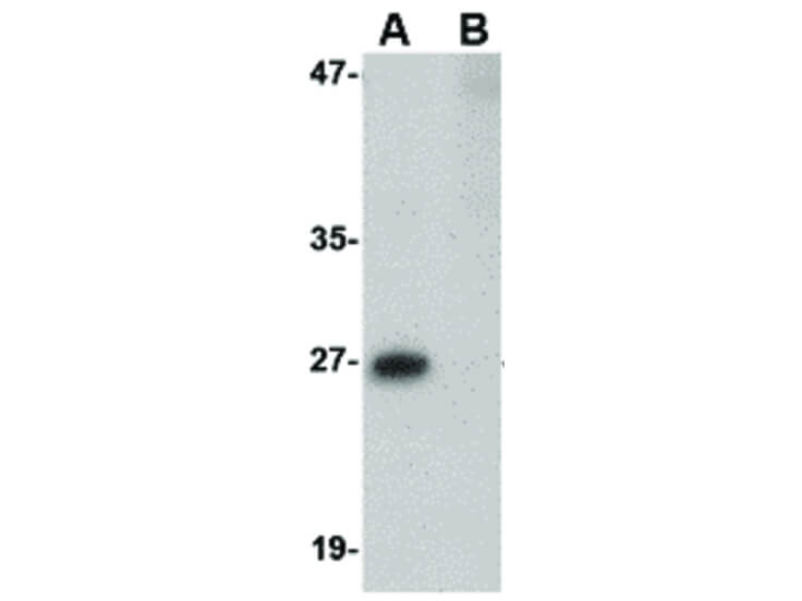 Western Blot of PRTFDC1 Antibody