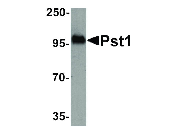 Western Blot of Pst1 Antibody