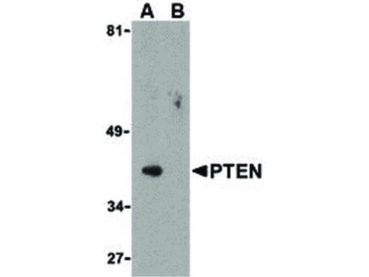 Western Blot of PTEN Antibody