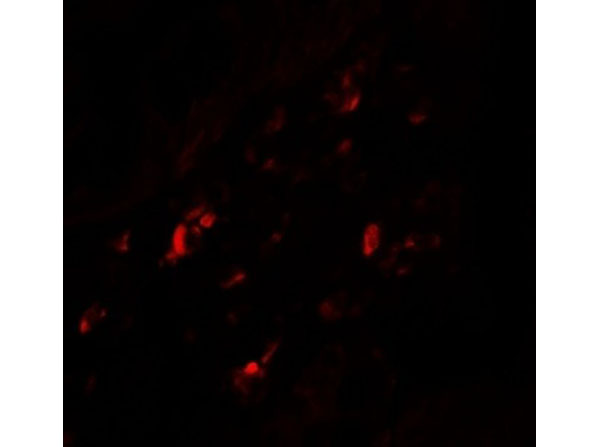 Immunofluorescence of PTGDR2